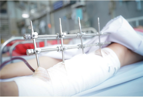 Dùng trí tuệ nhân tạo giám sát tiệt khuẩn dụng cụ mổ, giảm nhiễm khuẩn cho người bệnh